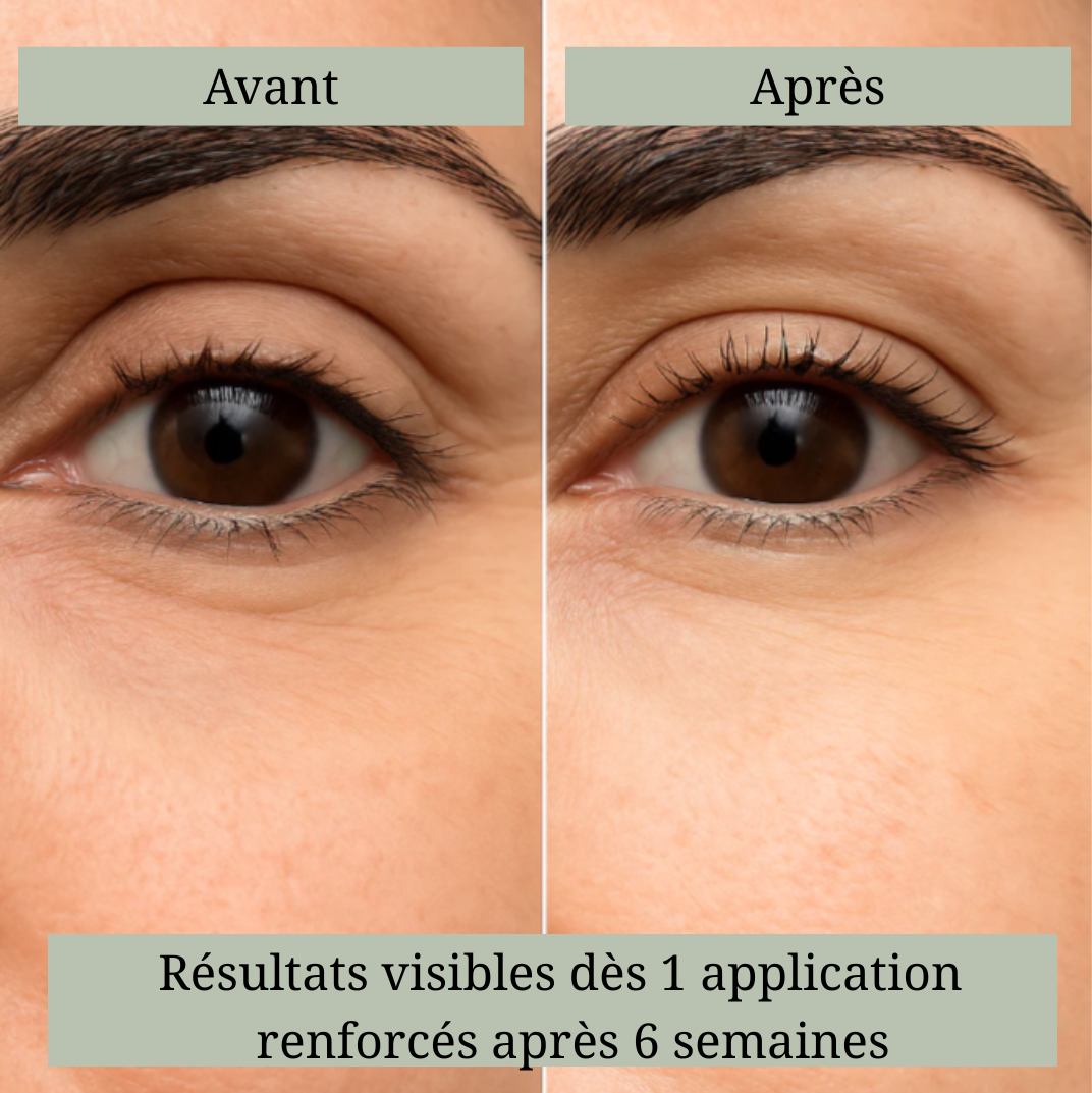 Patch Micro-Aiguilles
