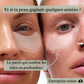Patch Micro-Aiguilles